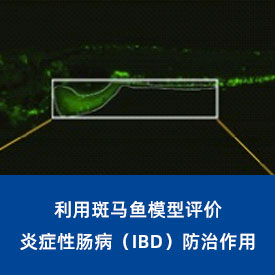 炎症性肠病（IBD）...