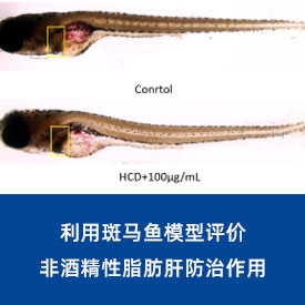 非酒精性脂肪肝...