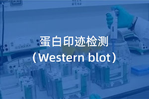 蛋白印迹实验（Western blot）...